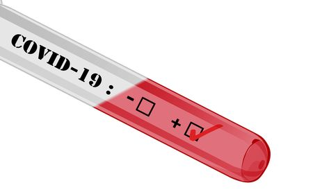 Vier op de tien Italianen willen geen vaccinatie tegen het Covid-19-virus covid
